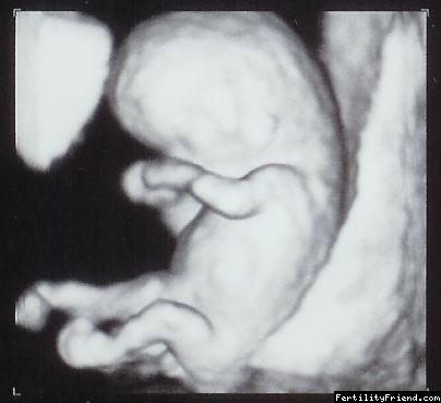 Obrázky plodu v těhotenství